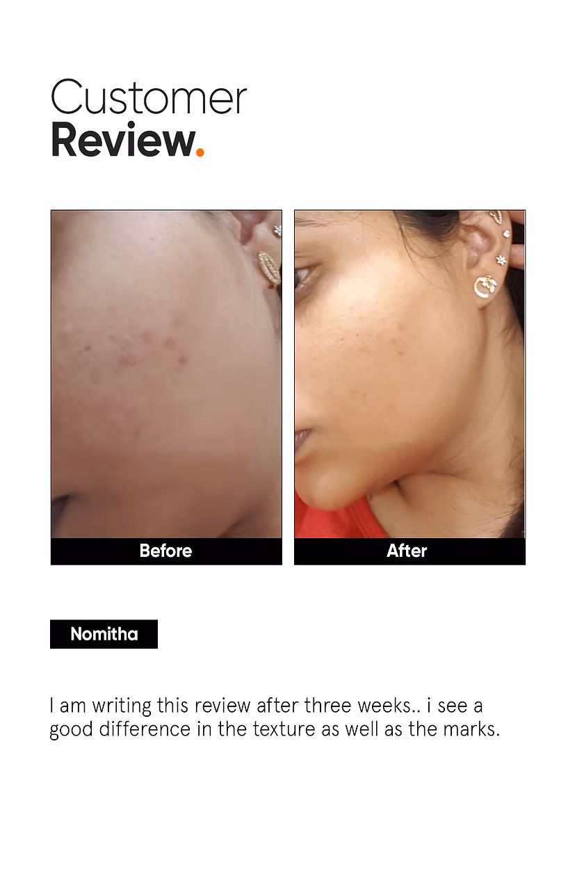 MINIMALIST - AHA PHA BHA 32 % - FACE PEEL