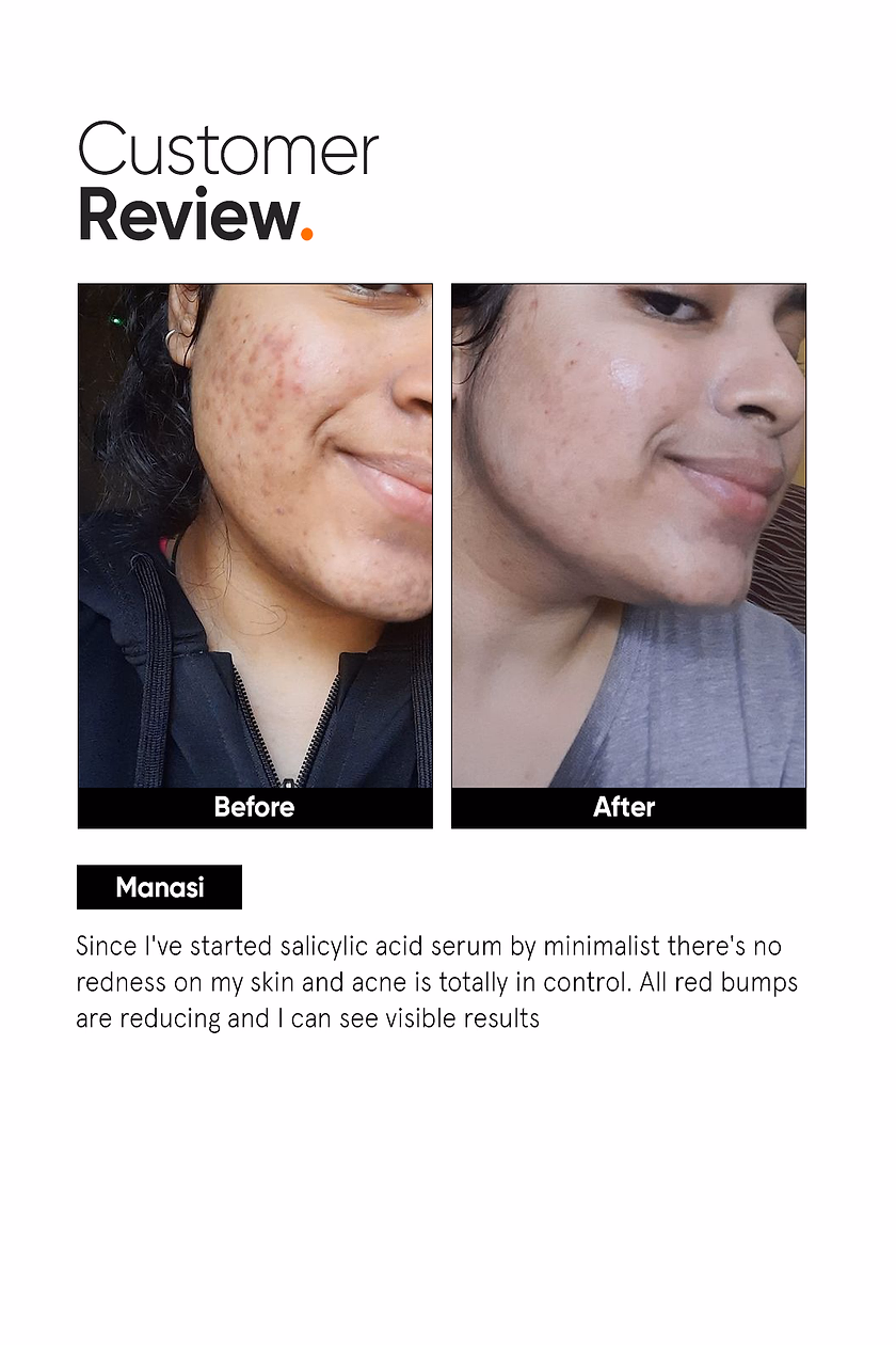 MINIMALIST - SALICYLIC ACID 02% - FACE SERUM