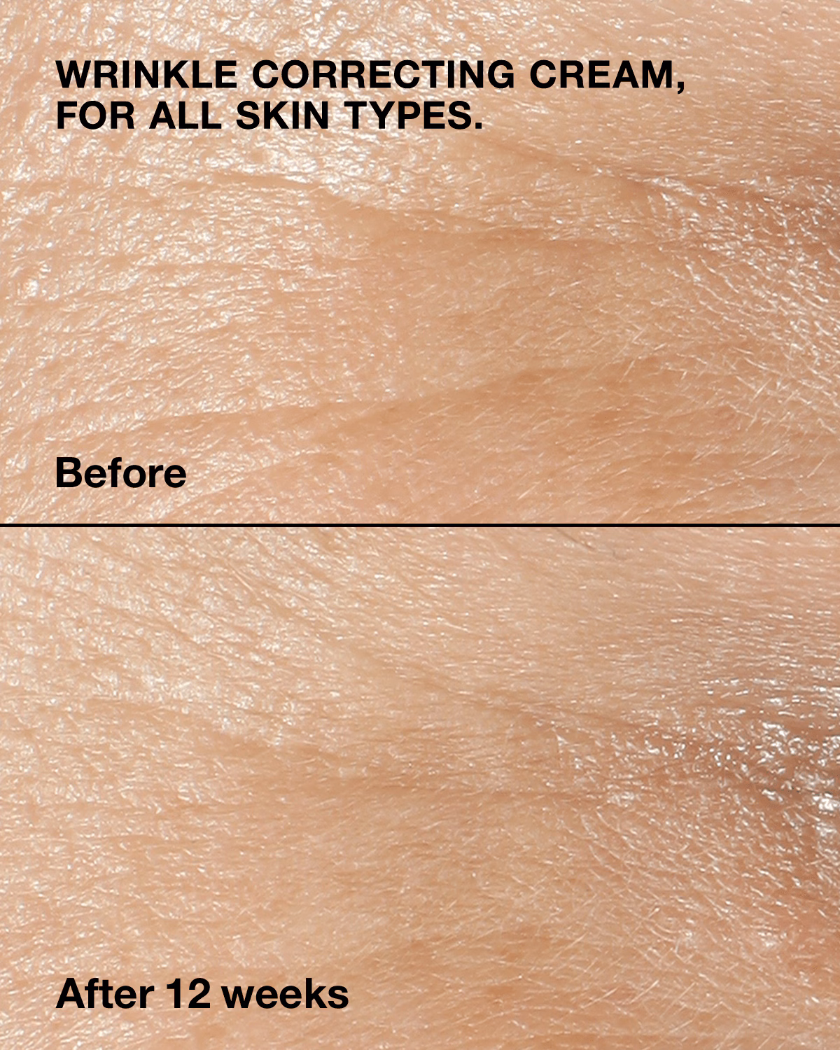 Clinique - Smart Clinical Repair™ Wrinkle Correcting Cream