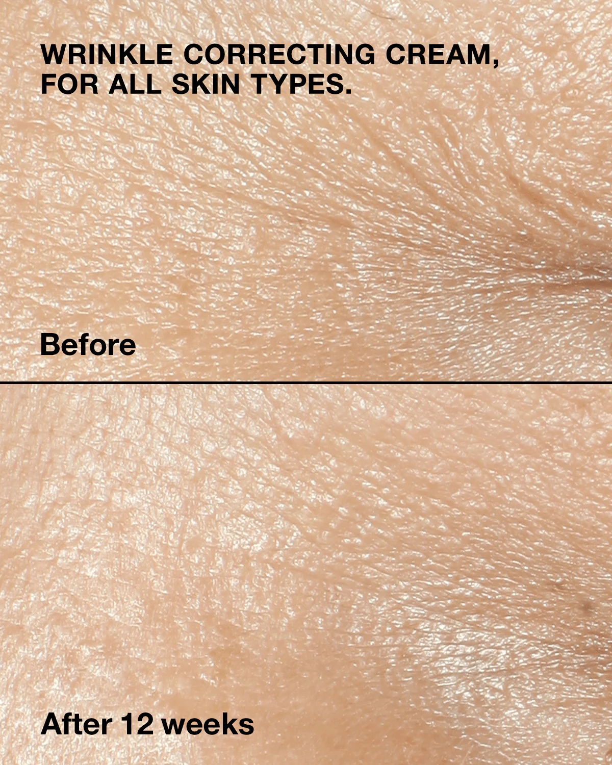 Clinique - Smart Clinical Repair™ Wrinkle Correcting Cream