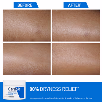 CERAVE - MOISTURIZING CREAM - BAUME HYDRATANT