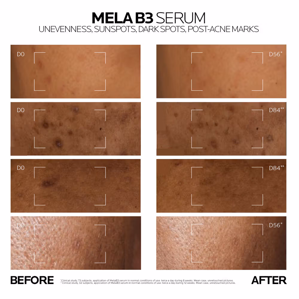 La Roche-Posay - Mela B3 Serum