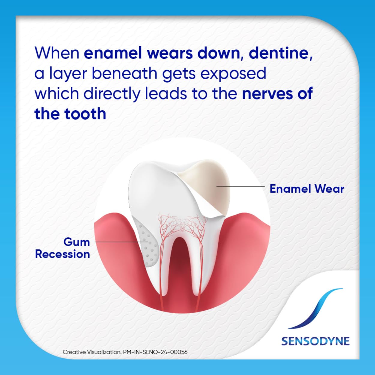 Sensodyne - Rapid Relief - Fast Sensitivity Relief-Toothpaste