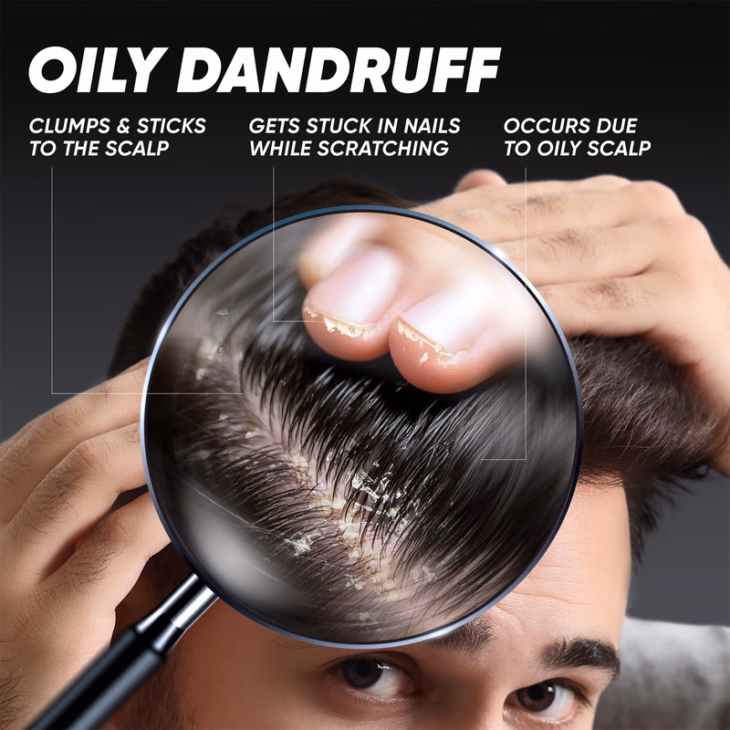 Head & Shoulders - Deep Cleanse - Anti-Dandruff Shampoo - Active Charcoal