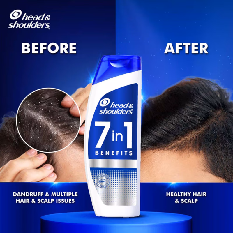 Head & Shoulders - 7-In-1 - Anti-Dandruff Shampoo