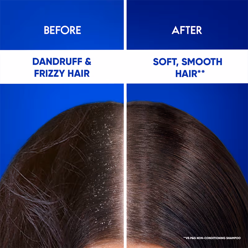 Head & Shoulders - Smooth and Silky - 2-In-1 Anti-Dandruff - Shampoo + Conditioner