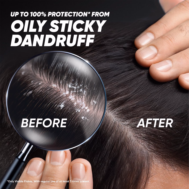 Head & Shoulders - Deep Cleanse - Anti-Dandruff Shampoo - Active Charcoal