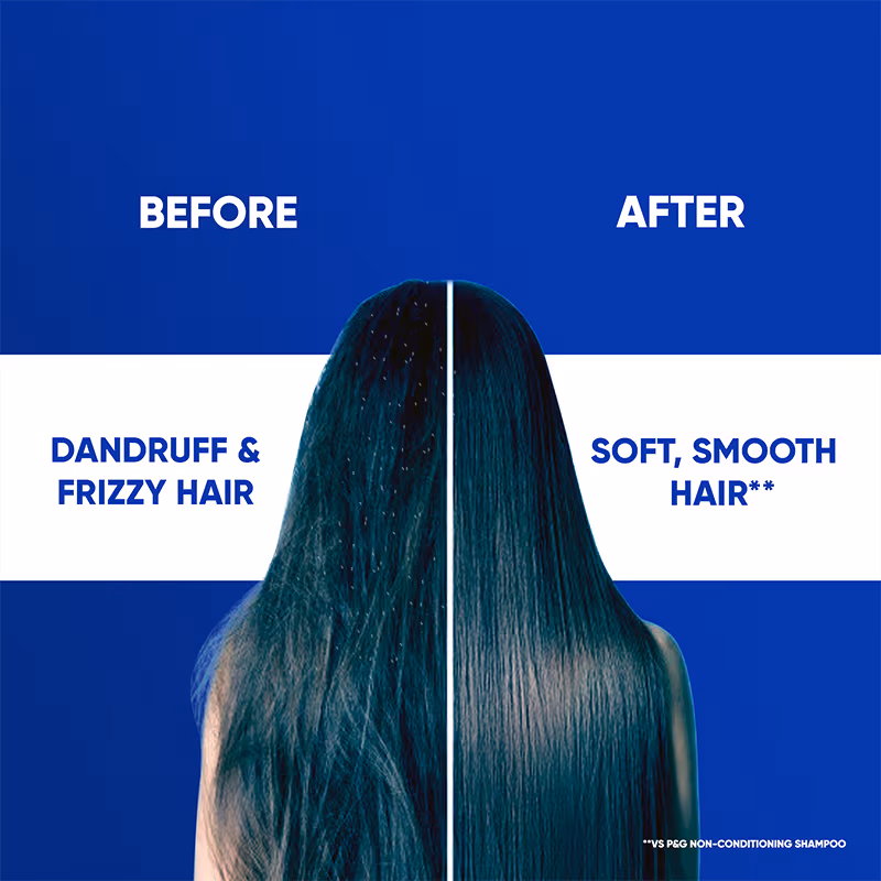 Head & Shoulders - Smooth and Silky - 2-In-1 Anti-Dandruff - Shampoo + Conditioner