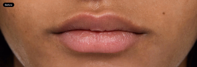 Torriden - SOLID IN - Lip Essence